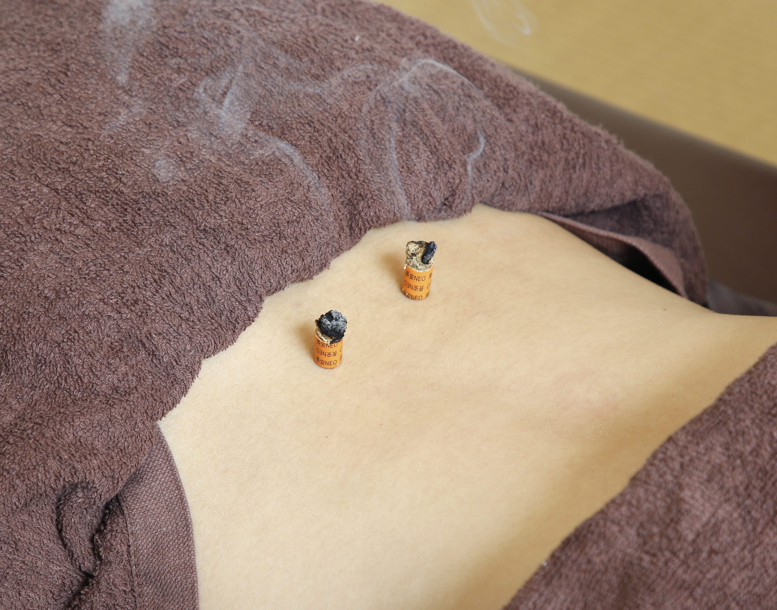 お灸を知ろう もりや はり きゅう庵